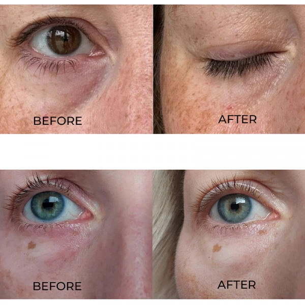 Eye Wonder – Image 3