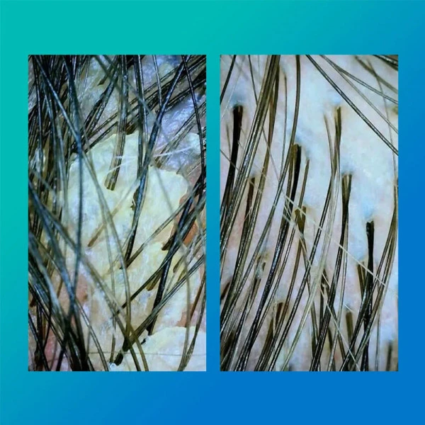 Peptide PREP Shampooing Détox – Image 5